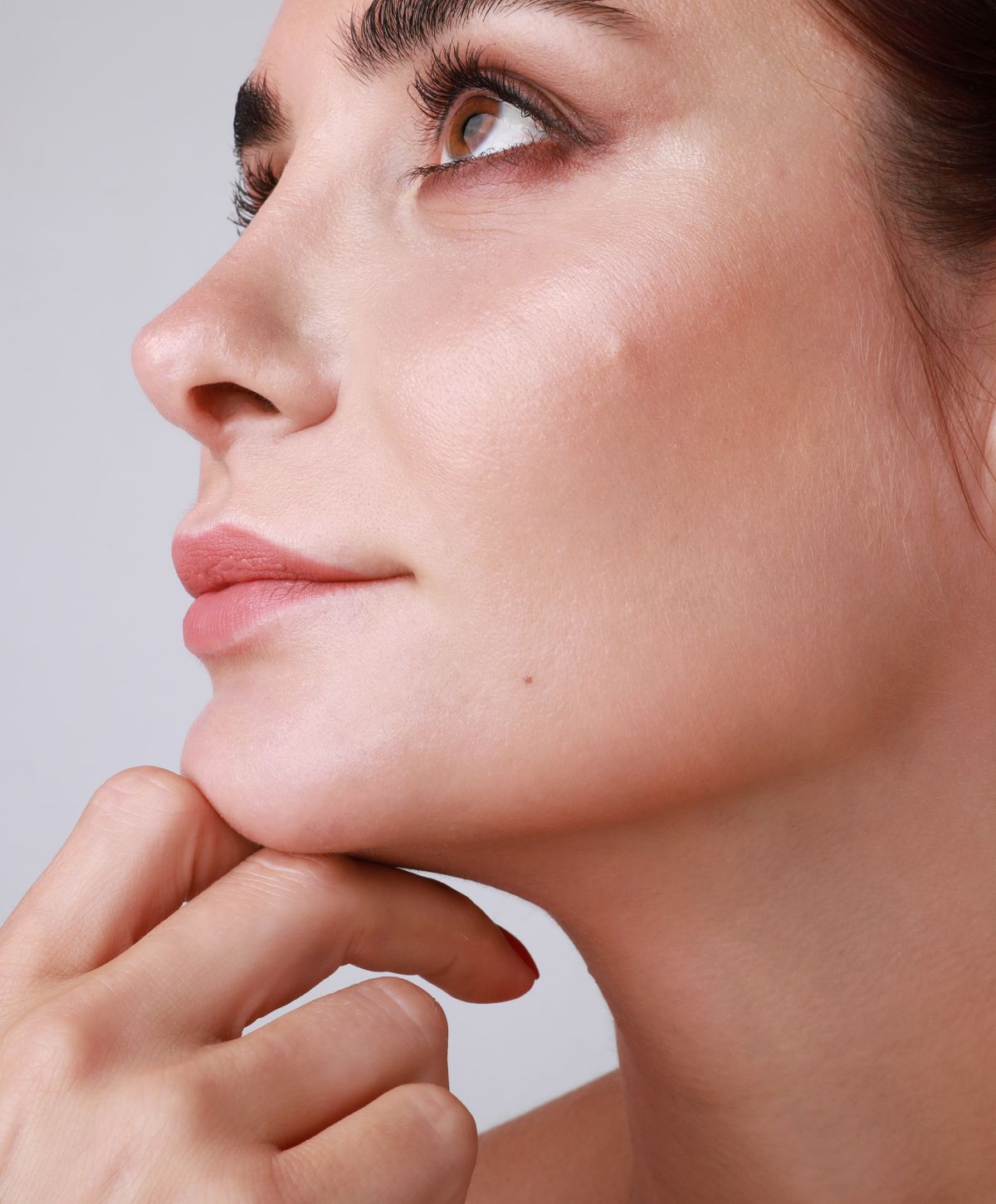 dysport patient model lookin up with her fingers on her chin